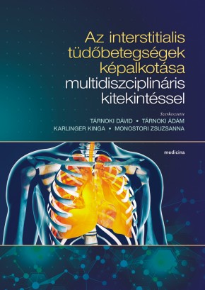 Az interstitialis tüdőbetegségek képalkotása multidiszciplináris kitekintéssel 2209
